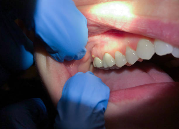 Best Emergency TMJ Treatment in Scott City, KS