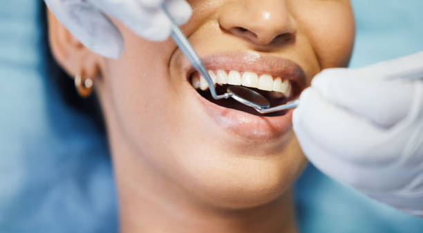 Best Emergency Dental Care for Broken or Chipped Teeth in Scott City, KS
